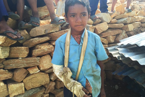 A boy who injured his arm in earthquake